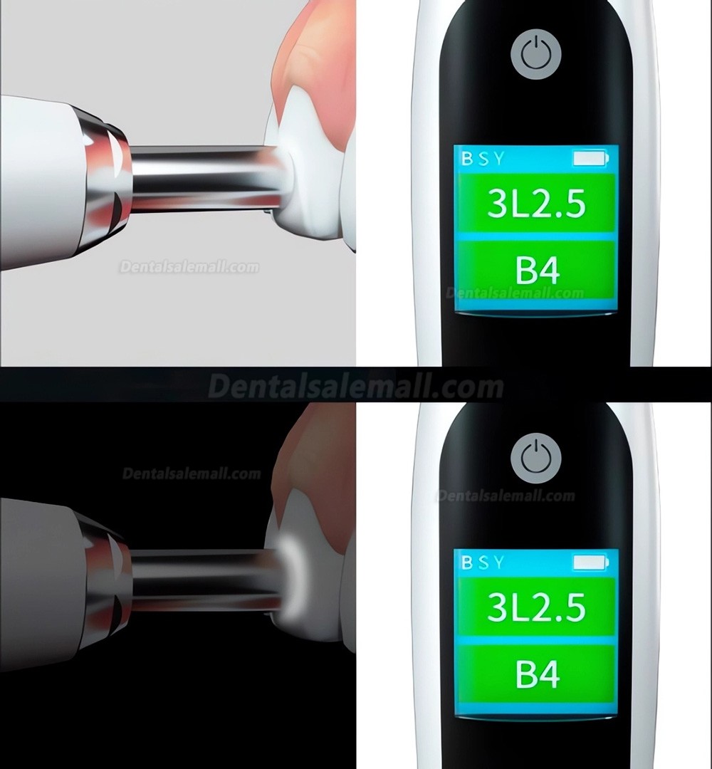 E220 Dental Digital Shade Guide Compatible with VITA / 3D-Master